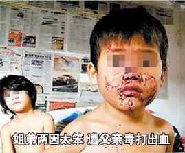 【<em>毒打</em>】一顿毒打_<em>后妈毒打6岁继女</em>_外祖父毒